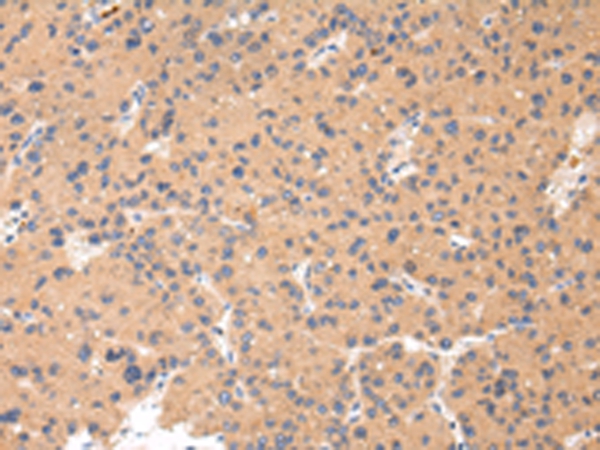 CTSK Antibody