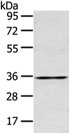 GJB5 Antibody