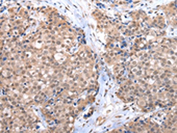 CTBP1 Antibody