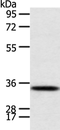 CALB2 Antibody