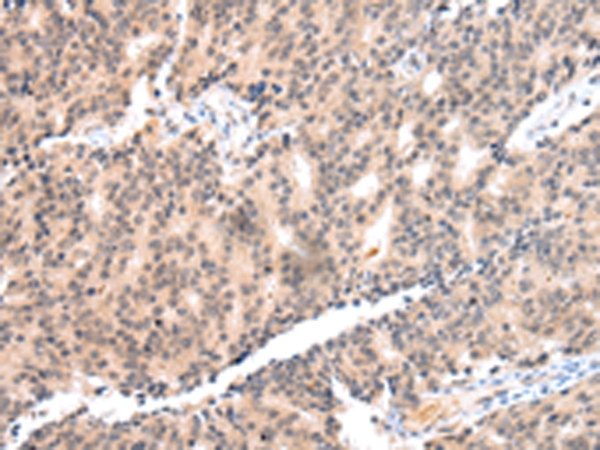 COX17 Antibody