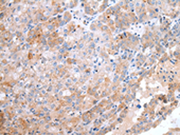 CCR10 Antibody