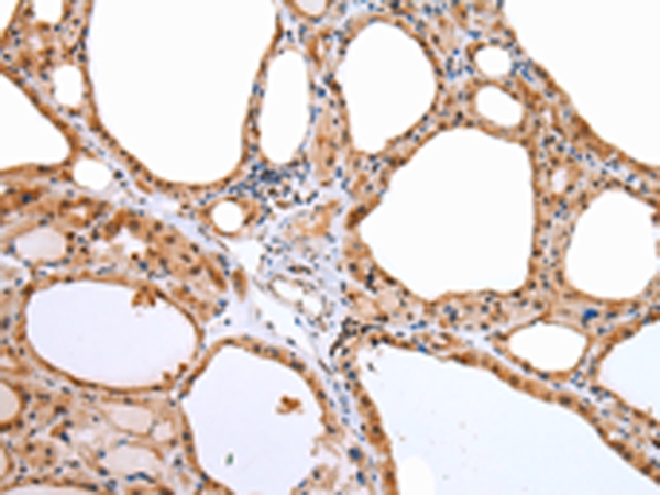 AQP9 Antibody