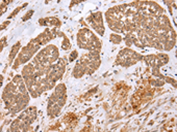 E2F5 Antibody