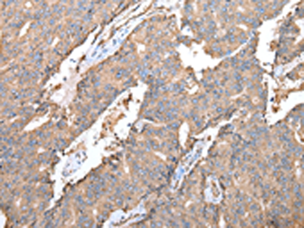 SPINK7 Antibody