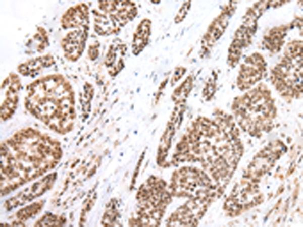 FOXG1  Antibody