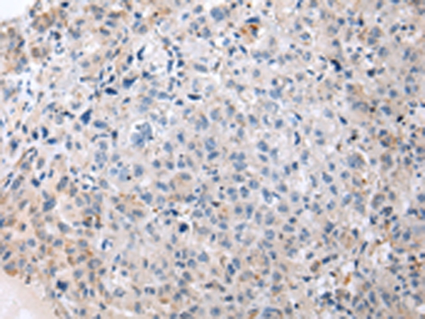 ENPP1 Antibody