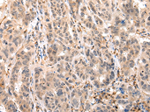 EPHB4 Antibody