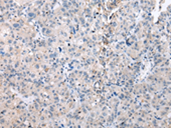 DUSP9 Antibody