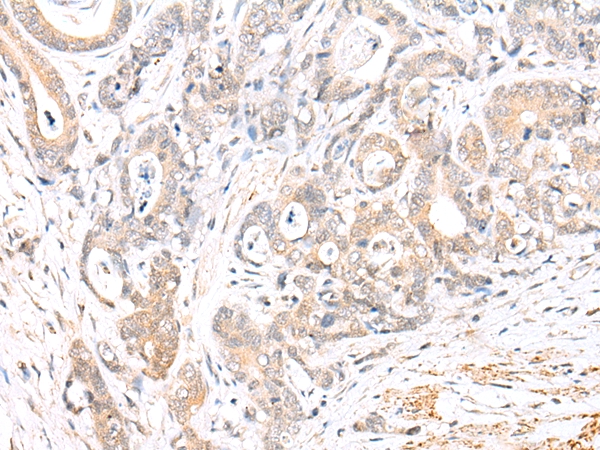 BCL2L11 Antibody