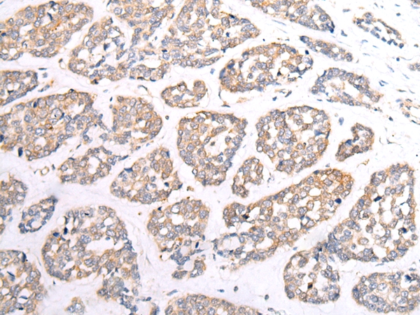 HTR1B Antibody