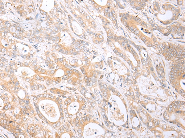 HTR1B Antibody