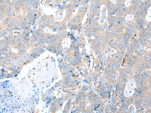 TRPV6 Antibody