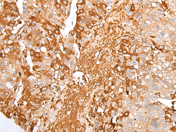 A2M Antibody