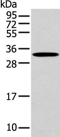 NANOS1 Antibody