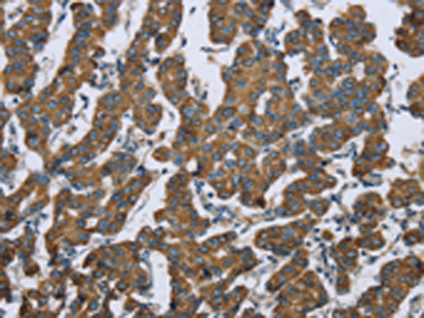 KRT5 Antibody