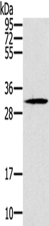 DKK1 Antibody