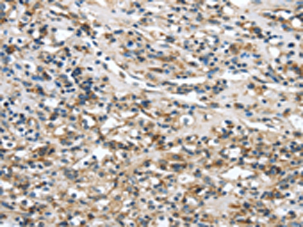 GLP2R Antibody