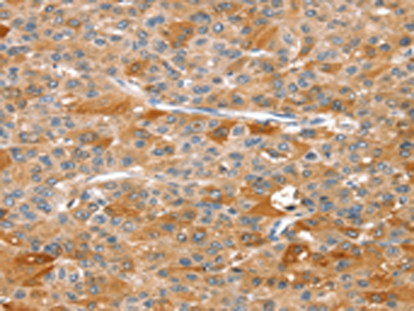 DSTYK Antibody