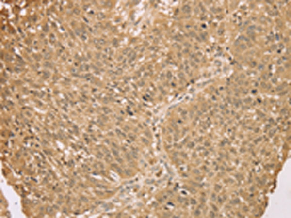 S100A11 Antibody