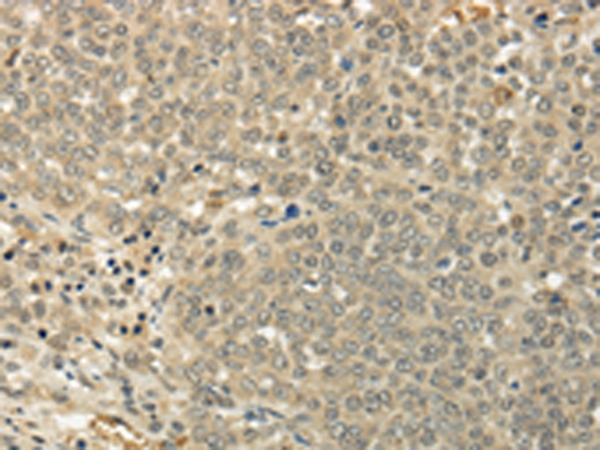 SIAH1 Antibody