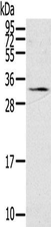 STAR Antibody