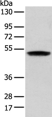 ZNF621 Antibody