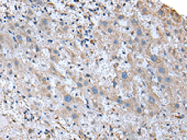 UBE2J2 Antibody