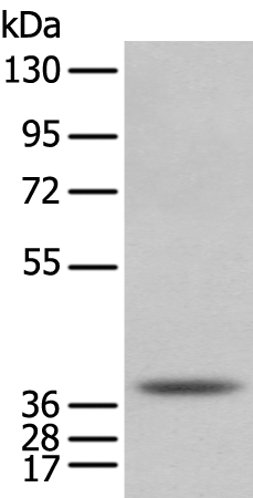 NUDT6 Antibody