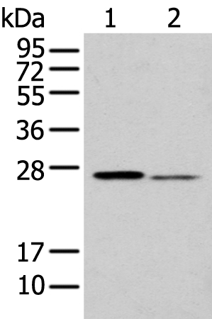 GSTM2 Antibody