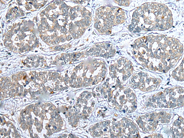 COMMD10 Antibody