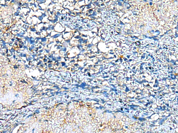 COMMD10 Antibody