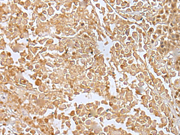 RILPL2 Antibody