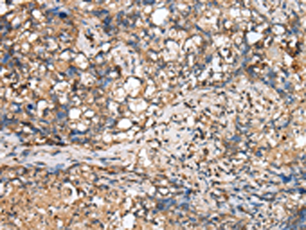 TINAGL1 Antibody