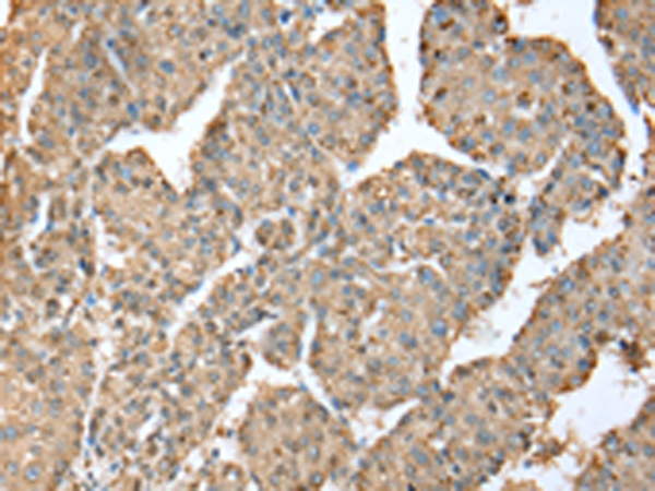 METTL7A Antibody