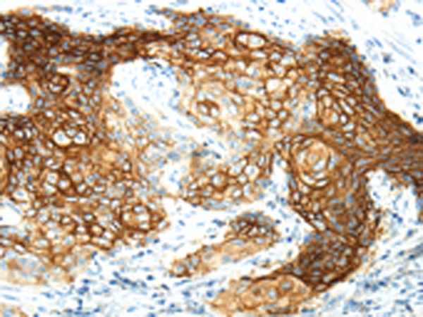 AQP3 Antibody