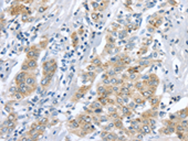 LRP6 Antibody