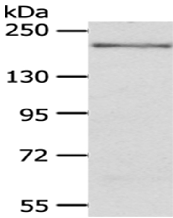 KDM6B Antibody