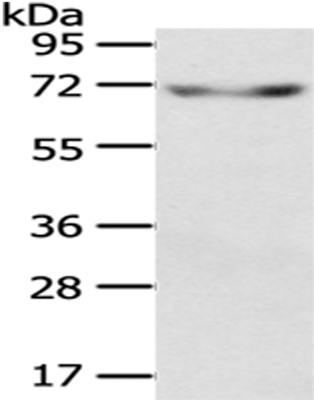 KL Antibody