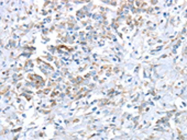 VWCE  Antibody