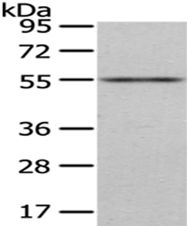 ENTPD1 Antibody