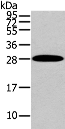 ZNF365 Antibody