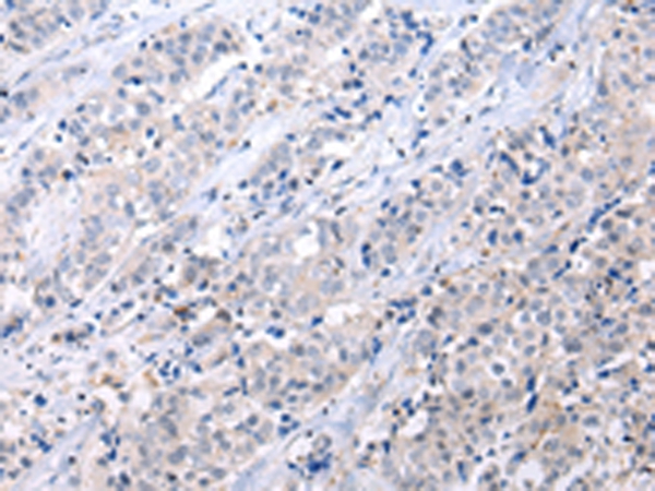 ATF6 Antibody