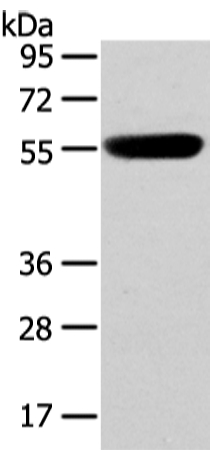 CBX4 Antibody