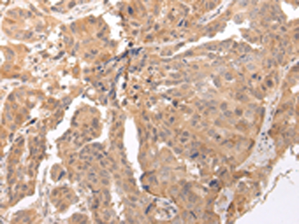 CLDND2 Antibody