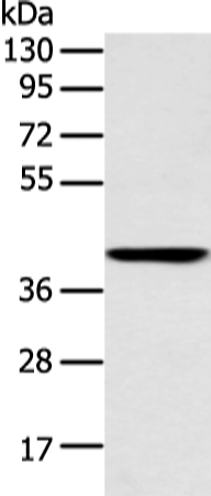 E2F1 Antibody