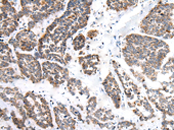 EPHB1 Antibody