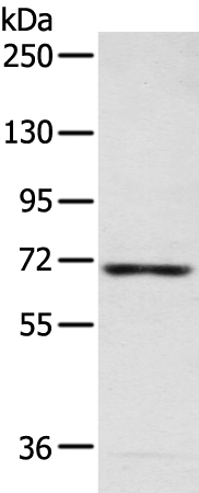 CAMKK2 Antibody