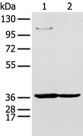 NUDT19 Antibody