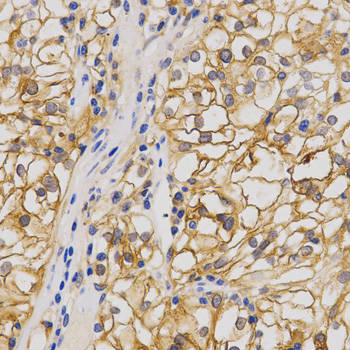 GRIA1 Antibody